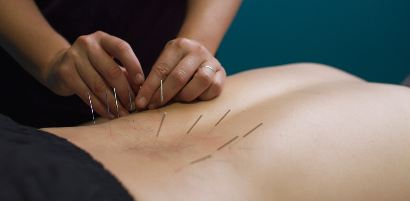 Dry-Needling-2000×980-smaller-1
